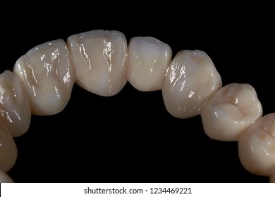 Monolithic Zirconia Teeth