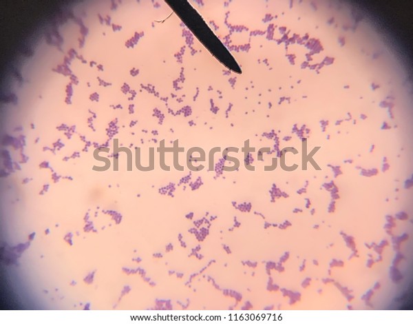 Morphology Bacteria Staphylococcus Aureus Cell Gram Stock Photo (Edit ...