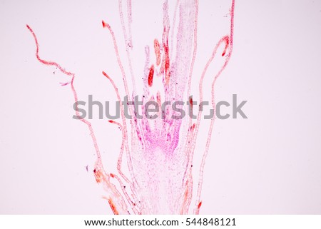 Moss, Archegonial and Head under a microscope. Stock photo © 