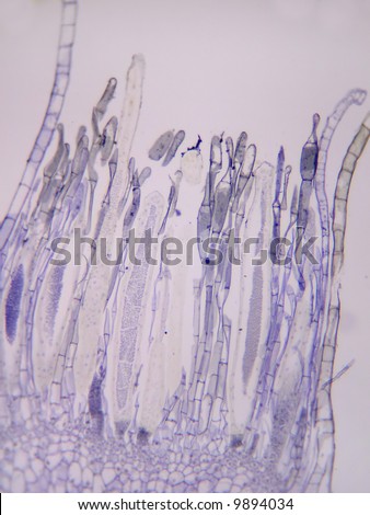 Moss (Polytrichium) antheridium.  Longitudinal section Stock photo © 