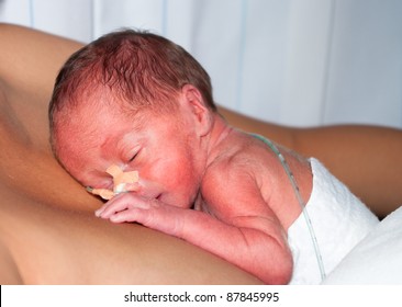 Mother Carrying Her Premature Baby On Her Breast