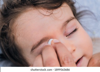 Mother Is Cleaning The Eyes Of A Child With A Cotton Strip Who Is Suffering From Purulent Conjunctivitis.