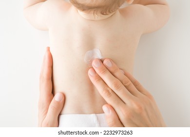 Mother hand applying white medical ointment on infant bare back. Red rash on skin. Allergy from milk formula or mother milk. Care about baby body. Closeup. Top down view. - Powered by Shutterstock