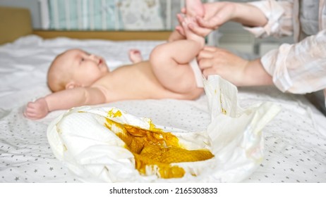 Mother Hands Clean Newborn Daughter Body With Wet Wipes After Changing Dirty Diaper. Bare Baby Girl Lies On Bed. Selective Focus On Diaper With Baby Poop