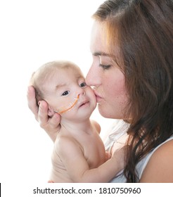 Mother holding kissing tiny special needs baby with nasogastric feeding tube