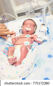 Mother Touching Her Premature Newborn Baby As He Is Hooked Up To An IV And Health Monitors While Being Treated In Intensive Care