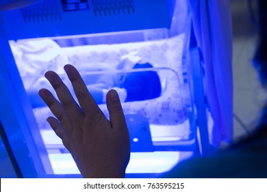 Mother Watching At The Newborn Baby With Hyperbilirubinemia / Neonatal Jaundice Under Blue UV Light For Phototheraphy On Infant Warmer In Neonatal Intensive Care Unit