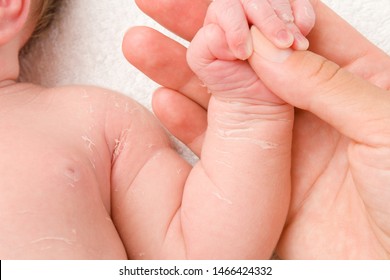 Mother's Hand Holding Newborn's Arm. Dry Skin. First Days After Birth. Care About Baby Clean And Soft Body Skin. Closeup.