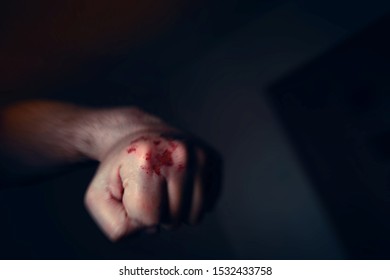 Motion Blur Effect Image Of Clenched Left Hand Fist With Bloody And Bruised Knuckles Prepared To Punch Again. Domestic Violence, Abuse Or Family Violence Concept.