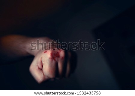 Motion Blur Effect Image of Clenched Left Hand Fist with Bloody and Bruised Knuckles Prepared to Punch Again. Domestic Violence, Abuse or Family Violence Concept.