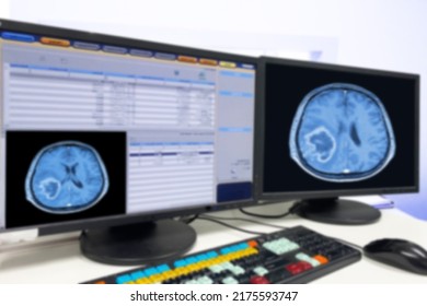 Motion Blur Medical CT Or MRI Or PET Brain Scan Film On A Computer Monitor. Technologically Advanced And Functional Medical Office.