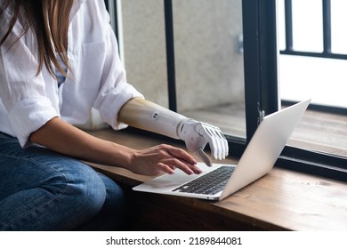 Motivated Woman Using Prosthetic Arm Working Or Learning Notebook Computer, Girl With Disability Typing Text Artificial Prosthetic Limb