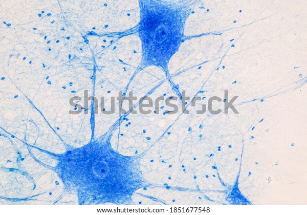 Motor Neuron under\
the microscope in Lab.\
