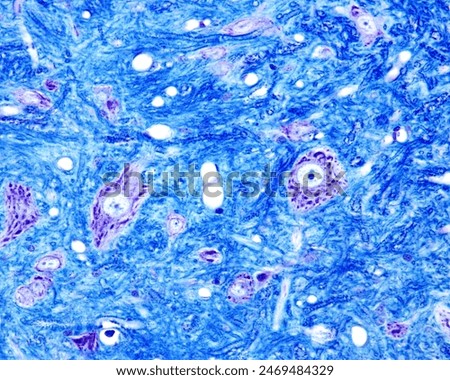 Motor neurons of the ventral horn of the spinal cord showing Nissl bodies in the cytoplasm of both the cell body and dendrites. Among neurons there are myelinated nerve fibers. Luxol Fast Blue stain.