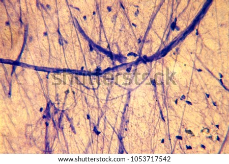 motorneuron under a microscope