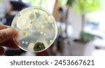 Mould test petri dish agar plate culture medium with spore colonies for measuring mold spores pollution contamination in the air indoors at home