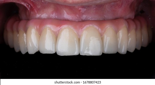 人間の歯 の画像 写真素材 ベクター画像 Shutterstock