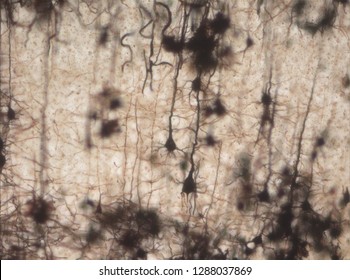 Mouse brain section stained with the Golgi stain, a 19th century technique that was  widely used until recently -  and occasionally still is. Widefield microscopy. Neurons in the cerebral cortex.