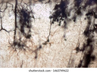 Mouse brain section stained with the Golgi stain, a 19th century technique that was  widely used until recently -  and occasionally still is.  Neurons and some vessel fragments in the cerebral cortex.
