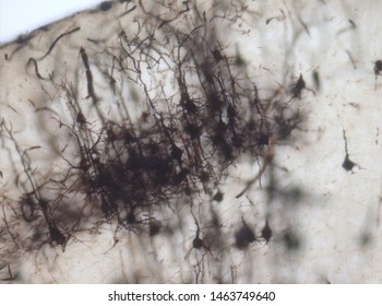 Mouse brain section stained with the Golgi stain, a 19th century technique that was  widely used until recently -  and occasionally still is.  Neurons and some vessel fragments in the cerebral cortex.