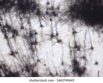 Mouse brain section stained with the Golgi stain, a 19th century technique that was  widely used until recently -  and occasionally still is.  Neurons and some vessel fragments in the cerebral cortex.