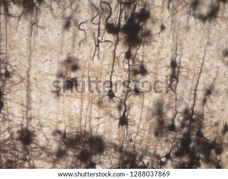 Mouse brain section stained with the Golgi stain, a 19th century technique that was  widely used until recently -  and occasionally still is. Widefield microscopy. Neurons in the cerebral cortex.