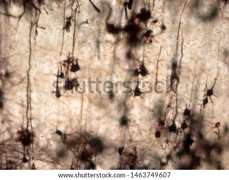 Mouse brain section stained with the Golgi stain, a 19th century technique that was  widely used until recently -  and occasionally still is.  Neurons and some vessel fragments in the cerebral cortex.