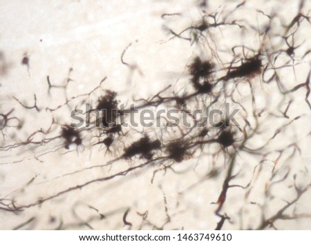 Mouse brain section stained with the Golgi stain, a 19th century technique that was  widely used until recently -  and occasionally still is.  Neurons and some vessel fragments in the cerebral cortex.