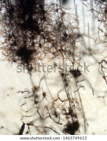 Mouse brain section stained with the Golgi stain, a 19th century technique that was  widely used until recently -  and occasionally still is.  Neurons and some vessel fragments in the cerebral cortex.