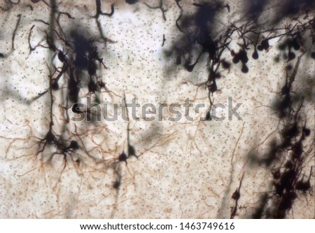 Mouse brain section stained with the Golgi stain, a 19th century technique that was  widely used until recently -  and occasionally still is.  Neurons and some vessel fragments in the cerebral cortex.