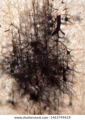 Mouse brain section stained with the Golgi stain, a 19th century technique that was  widely used until recently -  and occasionally still is.  Neurons and some vessel fragments in the cerebral cortex.