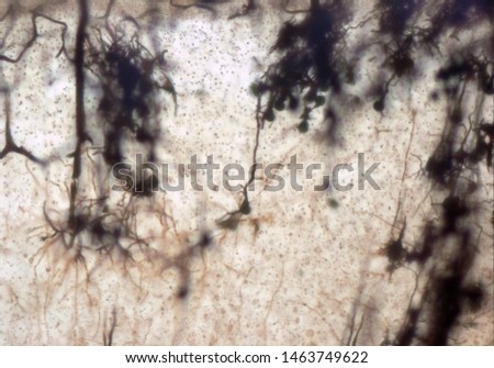 Mouse brain section stained with the Golgi stain, a 19th century technique that was  widely used until recently -  and occasionally still is.  Neurons and some vessel fragments in the cerebral cortex.