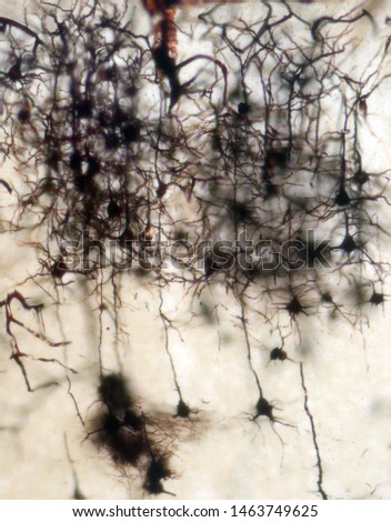 Mouse brain section stained with the Golgi stain, a 19th century technique that was  widely used until recently -  and occasionally still is.  Neurons and some vessel fragments in the cerebral cortex.