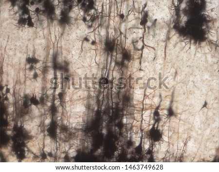 Mouse brain section stained with the Golgi stain, a 19th century technique that was  widely used until recently -  and occasionally still is.  Neurons and some vessel fragments in the cerebral cortex.