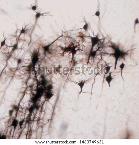 Mouse brain section stained with the Golgi stain, a 19th century technique that was  widely used until recently -  and occasionally still is.  Neurons and some vessel fragments in the cerebral cortex.