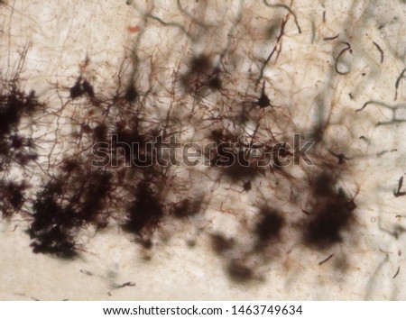 Mouse brain section stained with the Golgi stain, a 19th century technique that was  widely used until recently -  and occasionally still is.  Neurons and some vessel fragments in the cerebral cortex.