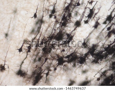 Mouse brain section stained with the Golgi stain, a 19th century technique that was  widely used until recently -  and occasionally still is.  Neurons and some vessel fragments in the cerebral cortex.