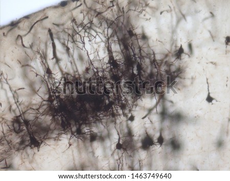 Mouse brain section stained with the Golgi stain, a 19th century technique that was  widely used until recently -  and occasionally still is.  Neurons and some vessel fragments in the cerebral cortex.
