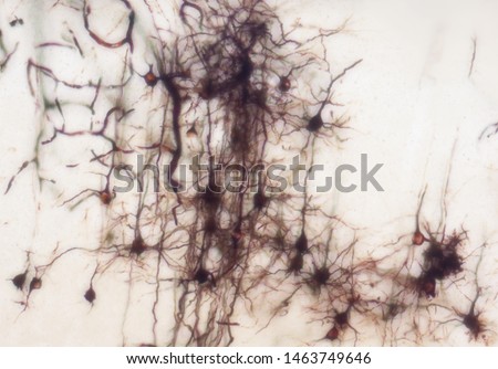 Mouse brain section stained with the Golgi stain, a 19th century technique that was  widely used until recently -  and occasionally still is.  Neurons and some vessel fragments in the cerebral cortex.