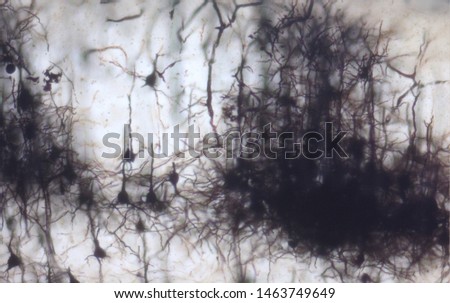 Mouse brain section stained with the Golgi stain, a 19th century technique that was  widely used until recently -  and occasionally still is.  Neurons and some vessel fragments in the cerebral cortex.