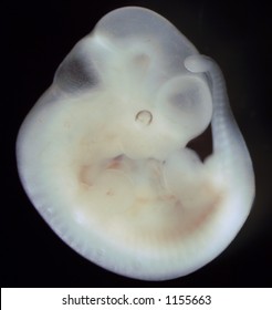 Mouse embryo, day 11 of development
