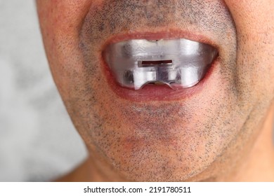 A Mouth Guard, Anti Snoring Is In A Man's Mouth