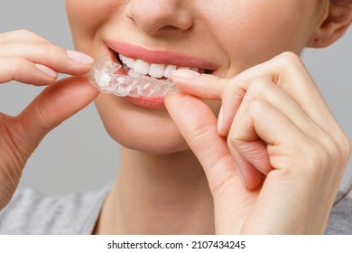 Mouth guard for teeth whitening. A young woman is doing a home teeth whitening procedure. - Shutterstock ID 2107434245