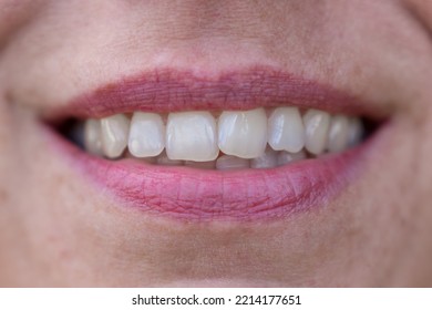 Mouth Of A Middle Aged Woman With Beautiful White Shiny Teeth In A Closeup