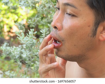 Mouth Ulcer, The Expression Of A Young Asian Man With Style As If He Is Taste Were Spicy. Spicy Concept