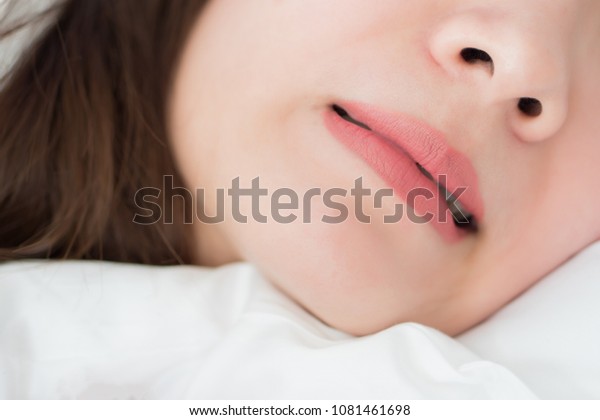 mouth of woman with grinding teeth, bruxism\
symptoms; mouth close up portrait of sleeping woman grinding her\
teeth with stress; mouth, oral, dental care medical concept; asian\
adult woman model