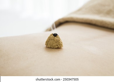 Moxibustion Of Back 