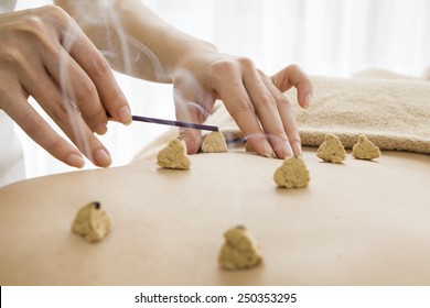 Moxibustion Treatment