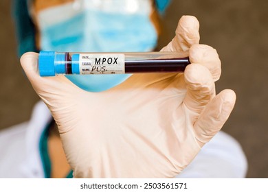 Mpox positive test samples. Diagnosis and laboratory. Doctors head and hand with glove. Studio shoot, white background.