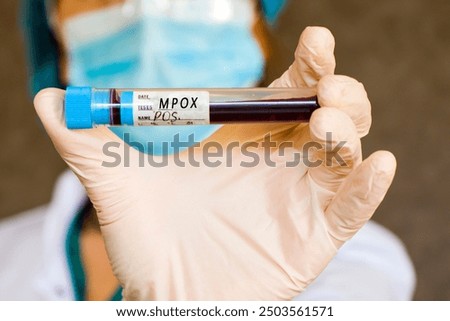 Mpox positive test samples. Diagnosis and laboratory. Doctors head and hand with glove. Studio shoot, white background.